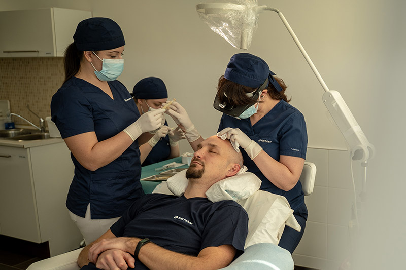 Greffe de cheveux : les conseils post-opératoires